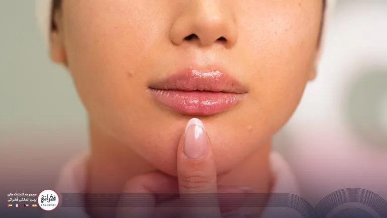 تزریق ژل لب مدل قلوه‌ای؛ روشی محبوب برای ایجاد جلوه‌ای خاص
