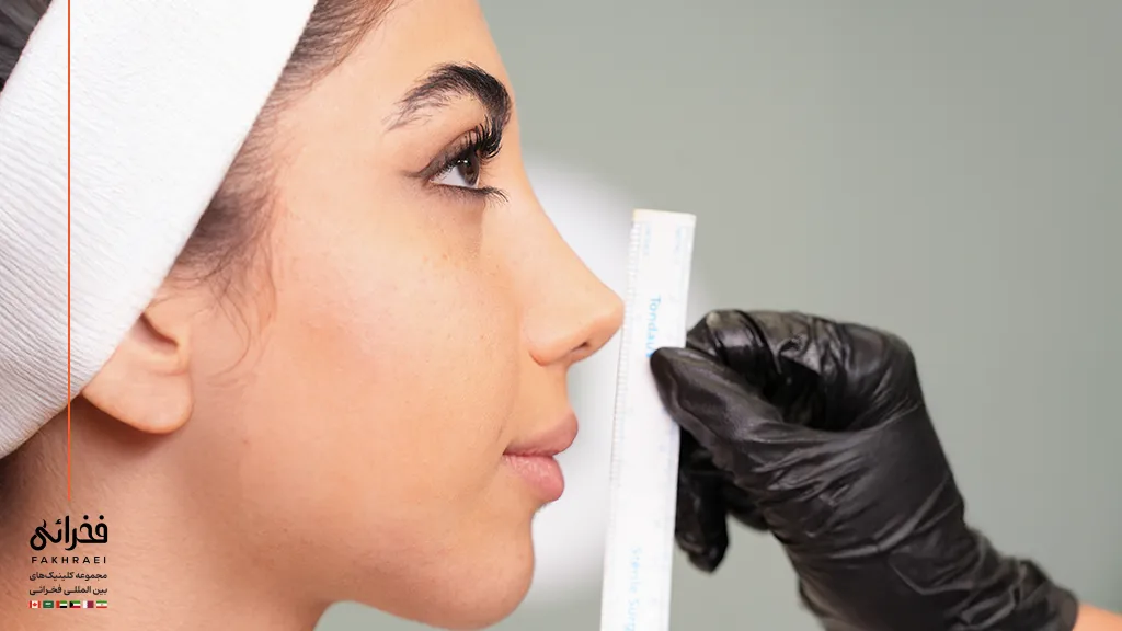 پزشک در حال بررسی مدل تزریق ژل لب بر اساس چهره فرد