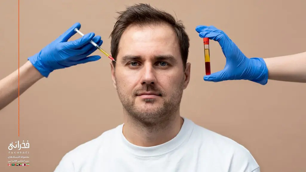 تزریف پی آر پی در کنار کاشت مو