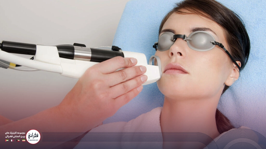 لیزر فوتونا برای منافذ باز پوست-در حال انجام لیزر فوتونا