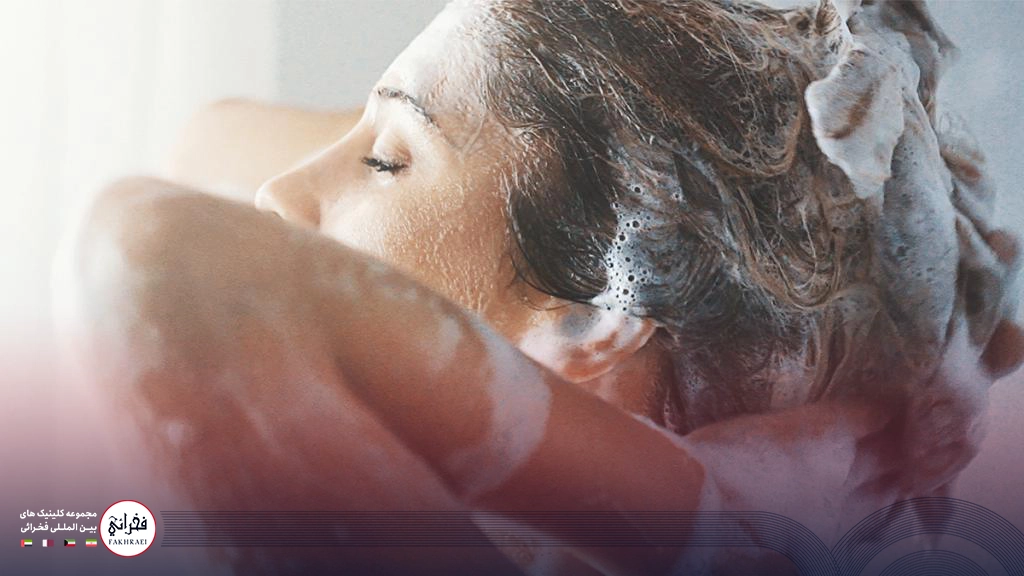 شامپو بعد از کاشت مو