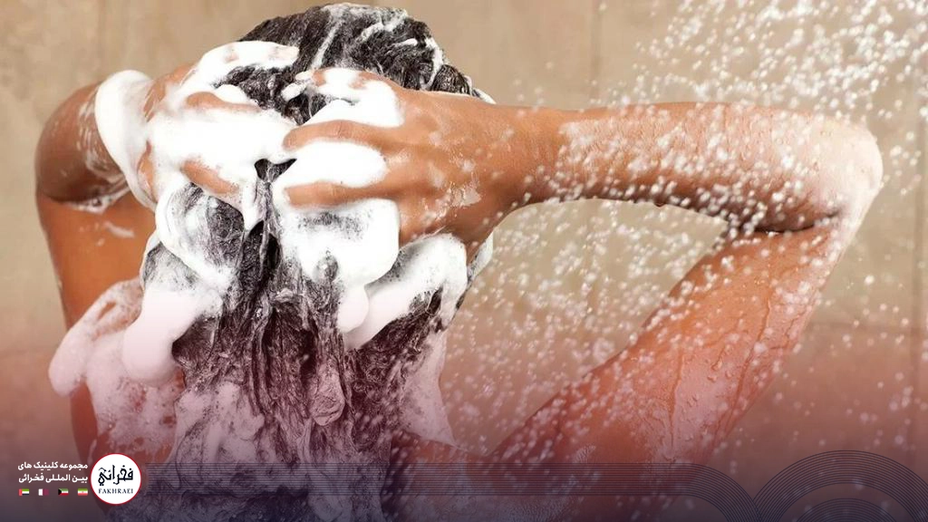شامپو بعد از کاشت مو -خانمی در حال شستن موهای خود