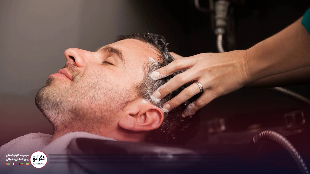 شامپو بعد از کاشت مو -شستن موی سر مردی با شامپو