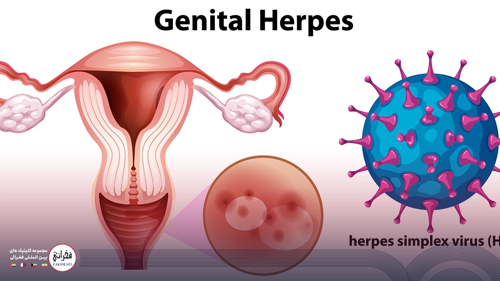نمایی از نقاشی رحم و تبخال