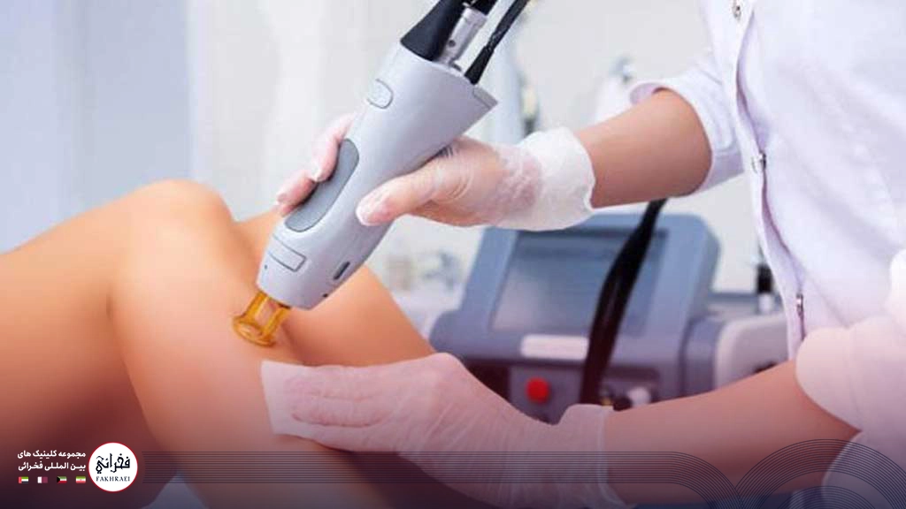 لیزر کندلا بهتره یا نابلکس؟-در حال انجام لیزر پای خانمی