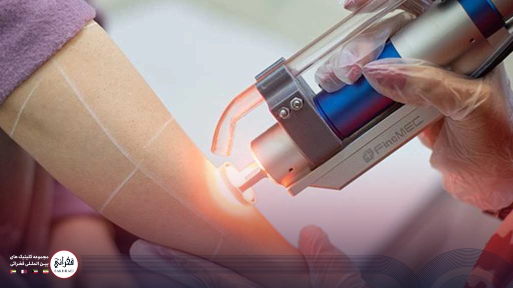 لیزر کندلا بهتره یا نابلکس؟-در حال انجام لیزر پای خانمی