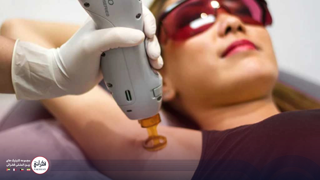 لیزر کندلا بهتره یا نابلکس؟-لیزر کندلا برای زیر بغل خانمی