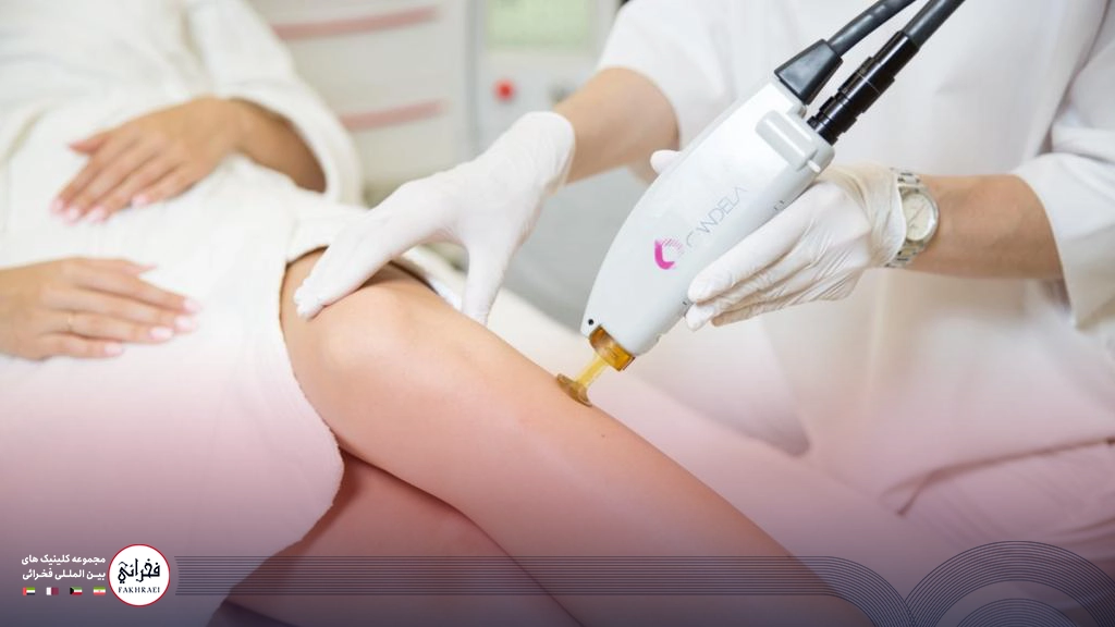 کندلا بهتره یا کلاریتی؟-در حال انجام لیزر کندلا روی ساق پا