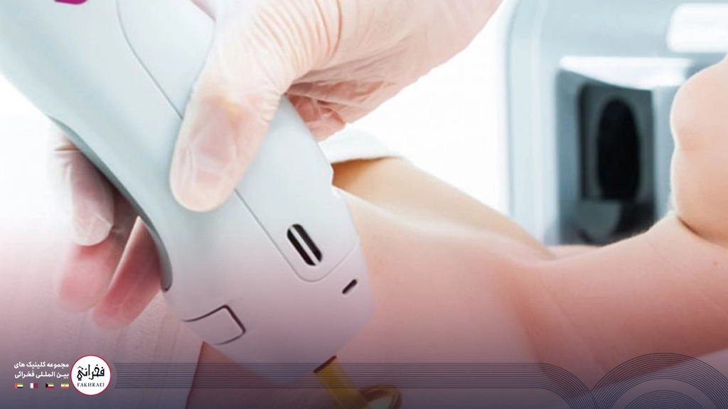 لیزر کندلا بهتره یا تیتانیوم؟-نمایی از لیزر کندلا