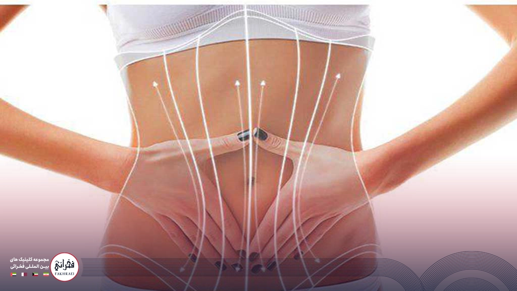 هایفوتراپی شکم-شکم خانمی