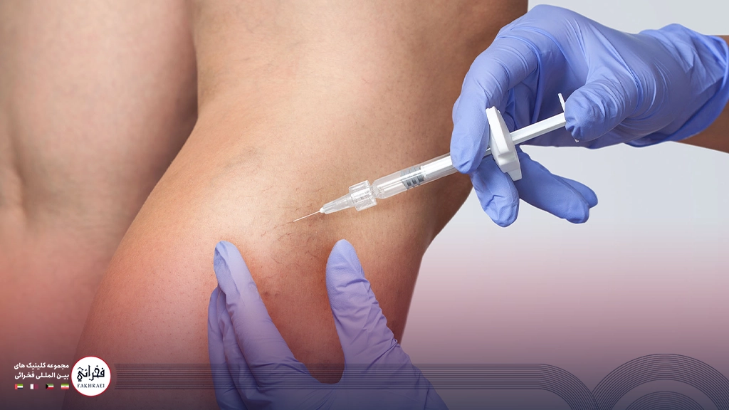 درمان واریس با اسکلروتراپی