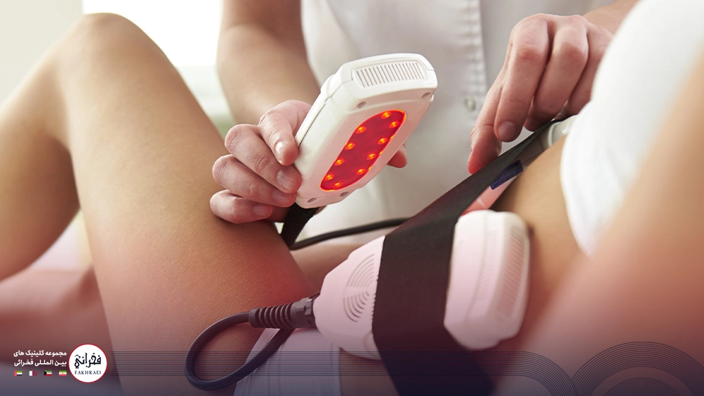 عوارض لاغری با دستگاه لیزر لیپولیز