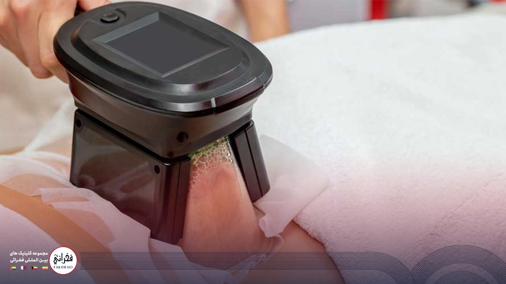 جوابدهی کرایولیپولیز-نمایی از دستگاه لاغری روی بدن خانمی