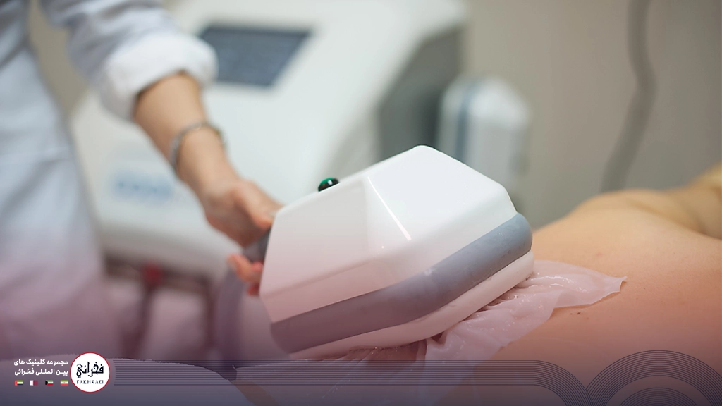 جوابدهی کرایولیپولیز-نمایی از دستگاه لاغری روی بدن خانمی