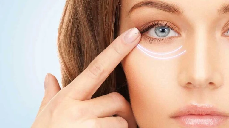 هایفوتراپی دور چشم