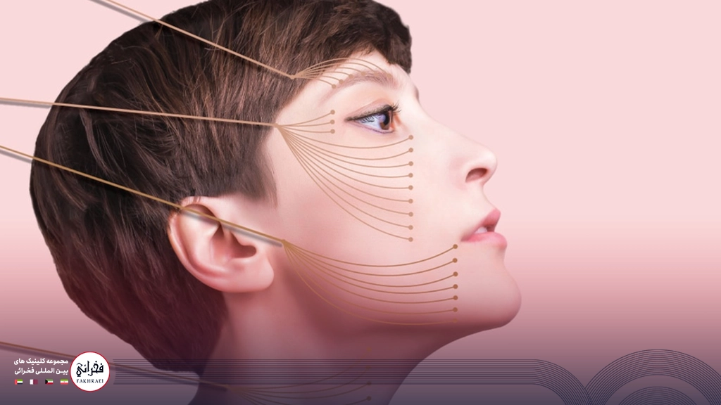 لیفت چشم با نخ -صورت خانومی در حال لیفت شدن