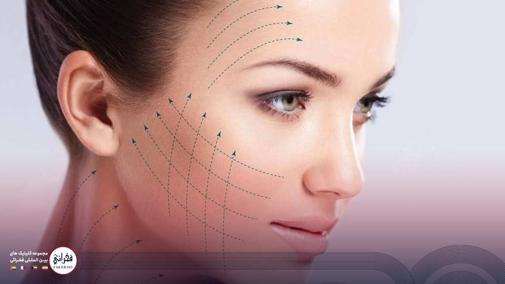 کاربرد لیفت گونه با نخ