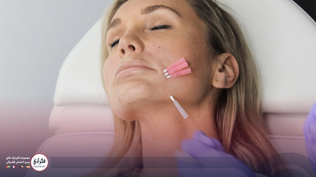 برجسته سازی گونه‌ها با لیفت با نخ