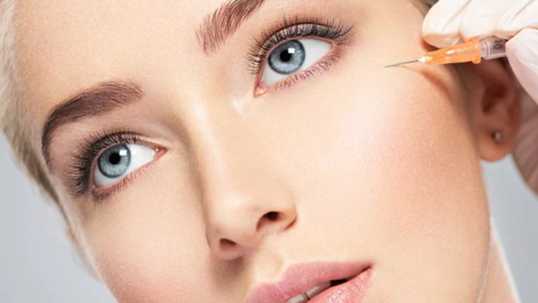 بوتاکس دور چشم-تزریق بوتاکس به زیر چشم خانومی