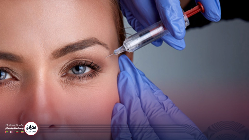 بوتاکس دور چشم-تزریق بوتاکس به دور چشم خانومی