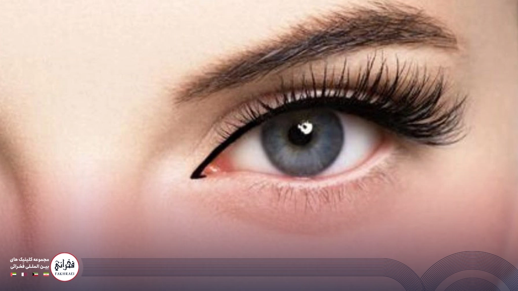 بوتاکس دور چشم-خانمی با چشمان آبی