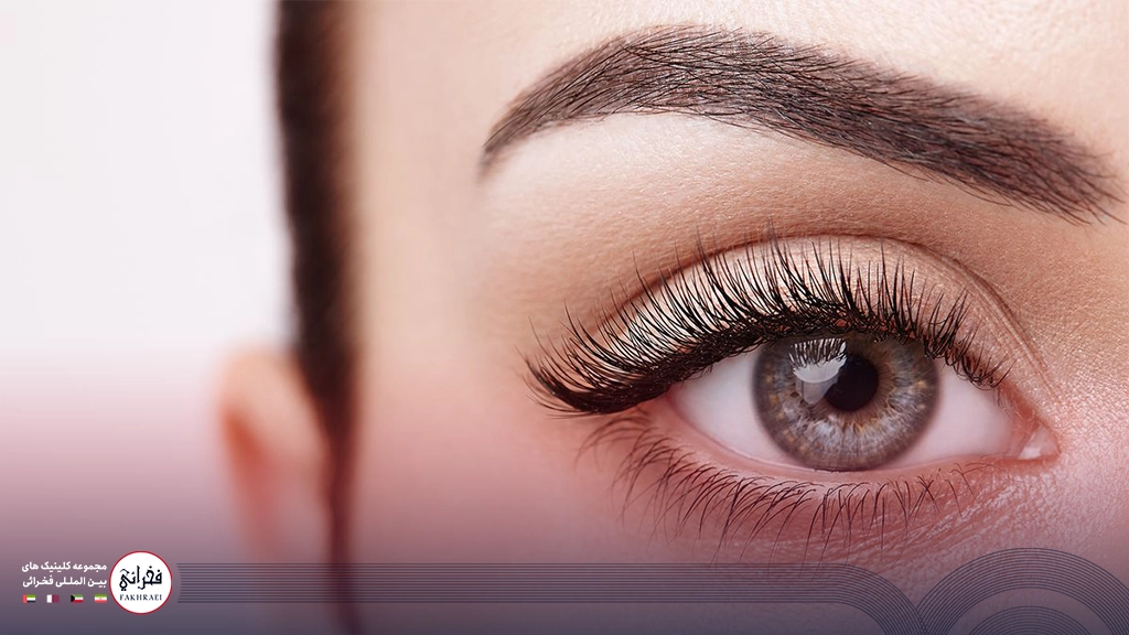 مزوتراپی ابرو -زنی با ابروهای زیبا