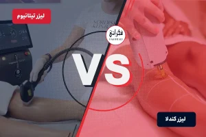 لیزر کندلا بهتره یا تیتانیوم؟