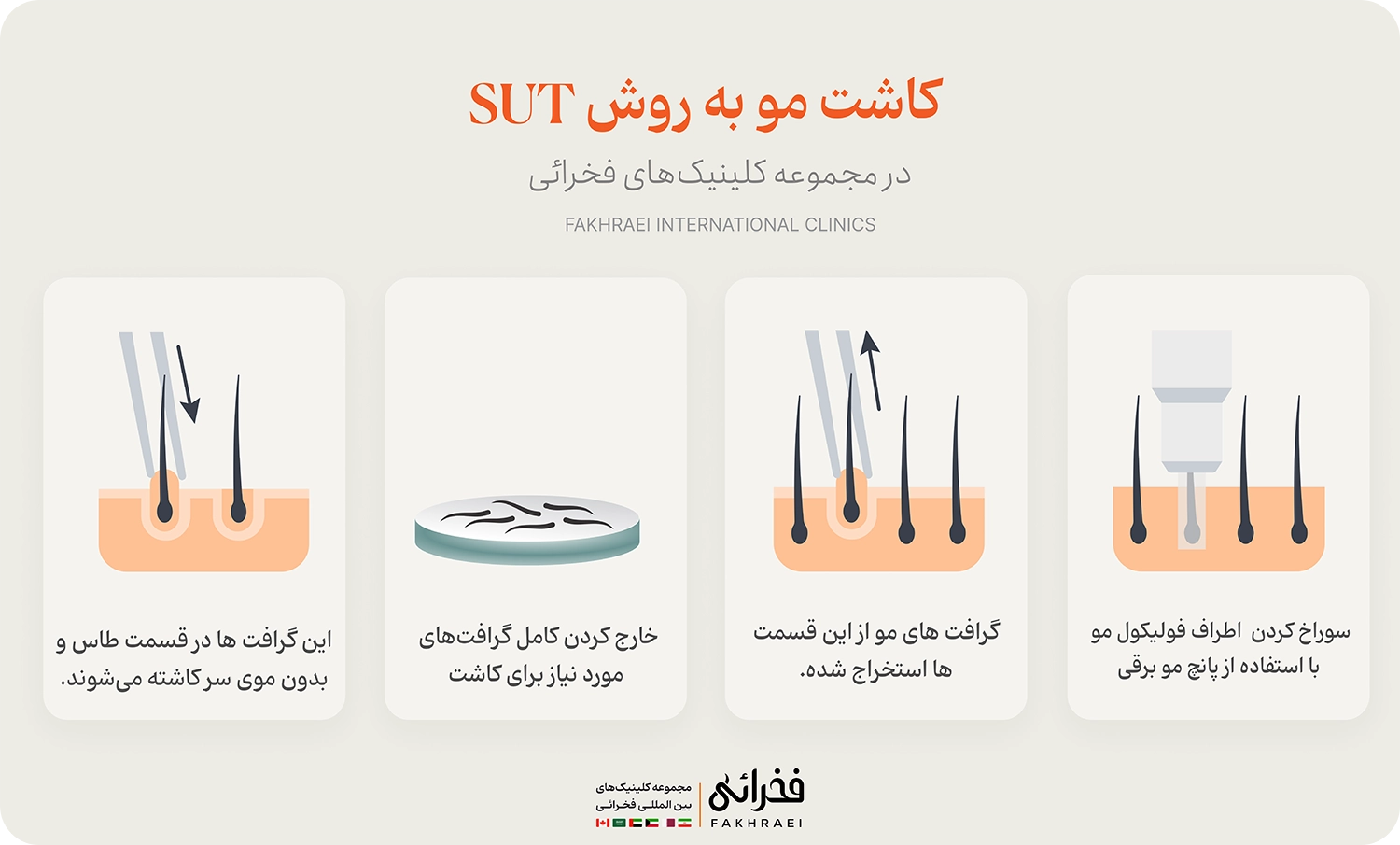 مراحل انجام کاشت مو SUT