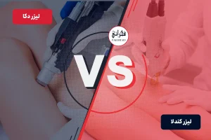 لیزر کندلا بهتره یا دکا؟
