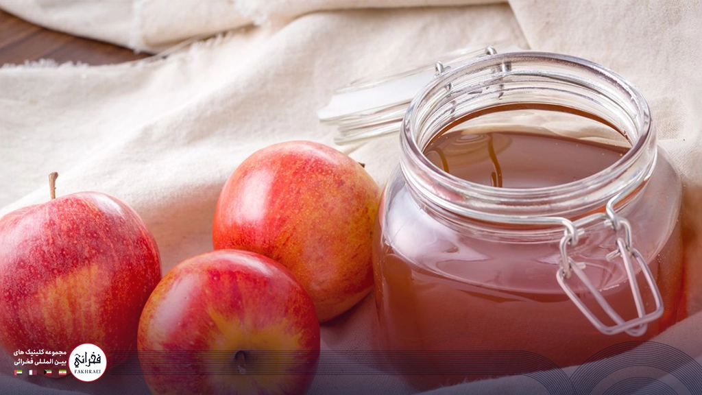درمان‌ شوره سر با سرکه سیب و تعدادی سیب