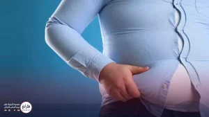 قرص لووکسین ۱۰۰ برای لاغری