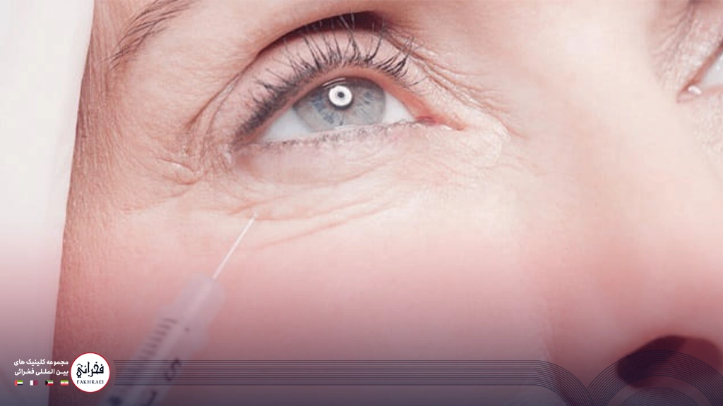 تزریق فیلر زیر چشم بدون درد 