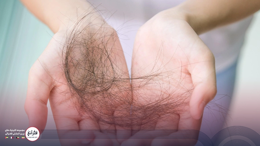 ریزش مو زیاد