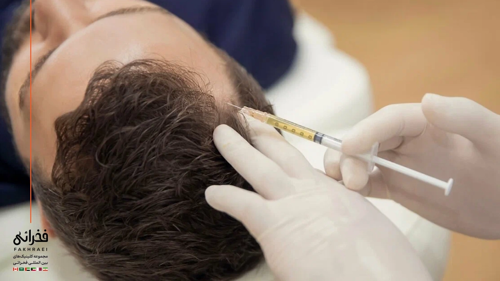 درمان ریزش مو