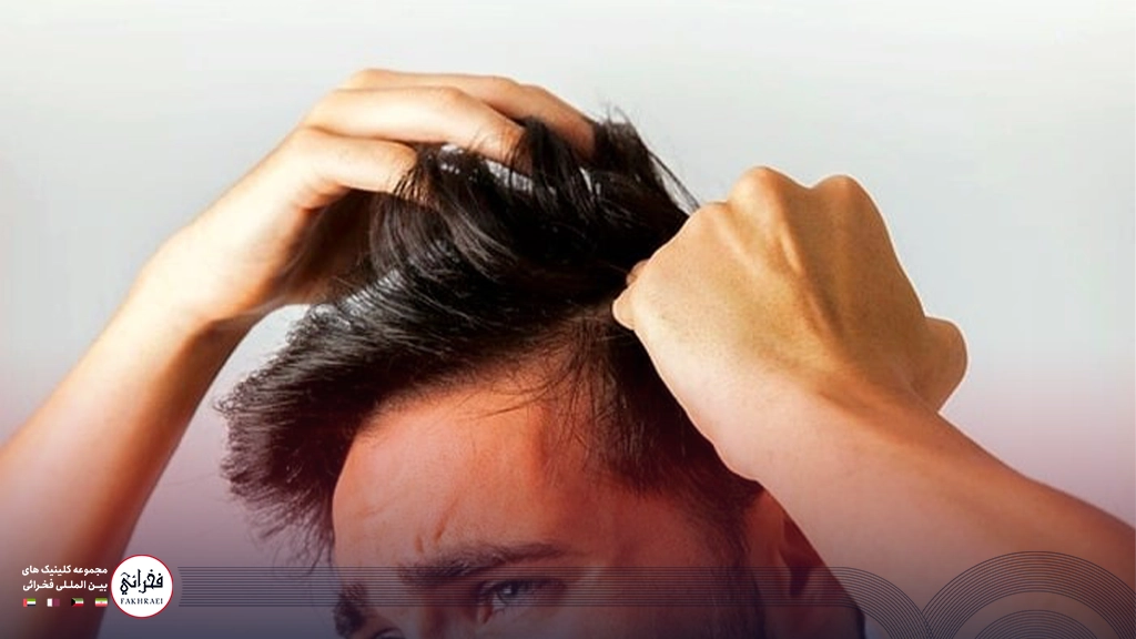 مردی پس از درمان قارچ پوست سر خود