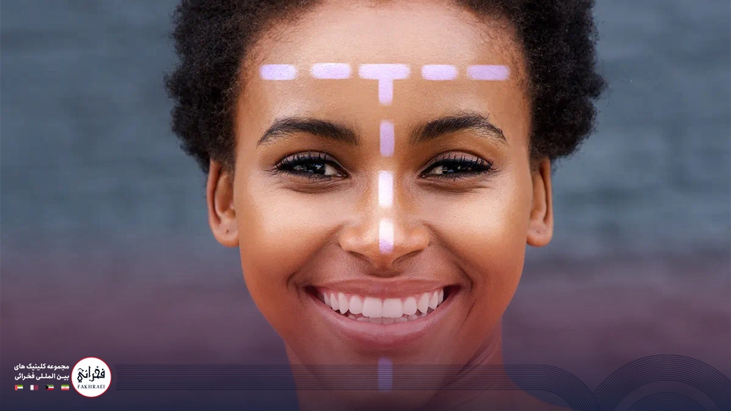 خانمی دارای پوست چرب در نقطه T صورت 