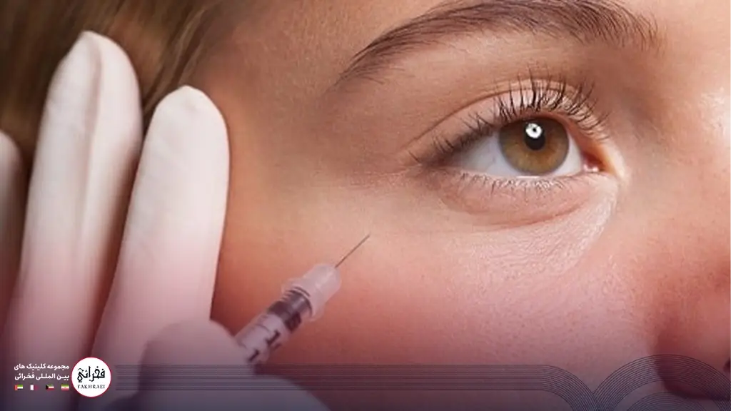 تزریق چربی برای درمان پف زیر چشم