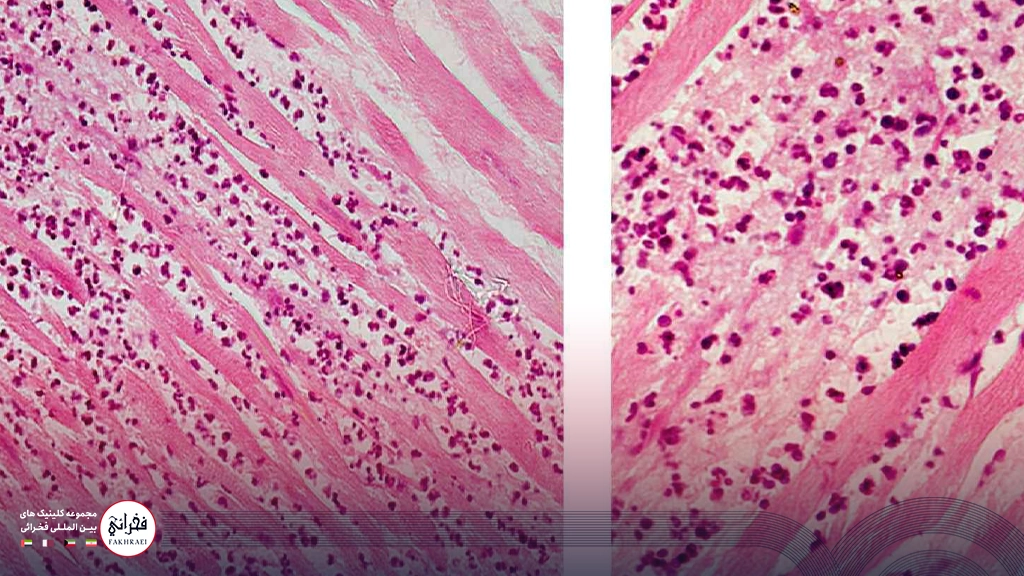 نمای آزمایشگاهی نکروز