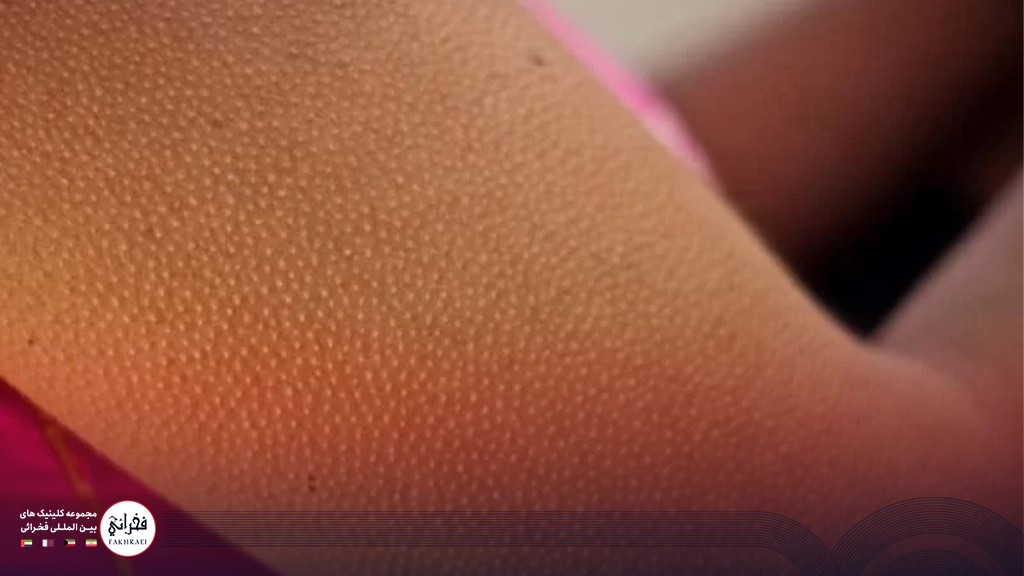 عکس نزدیکی از پوست مرغی شدن دست