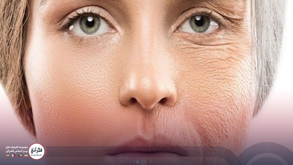 صورت خانمی که نیمی از صورت صاف نیمی با چین و چروک است