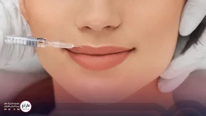 مراقبتهای بعد از تزریق آنزیم