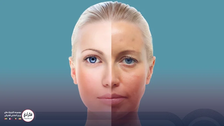 مراقبت بعد از مزوژل