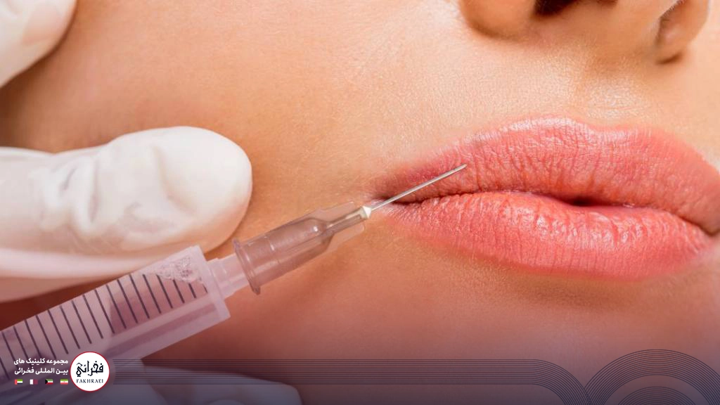  تزریق ژل لب