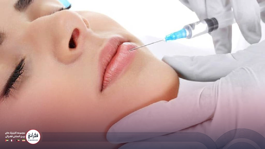  تزریق ژل لب