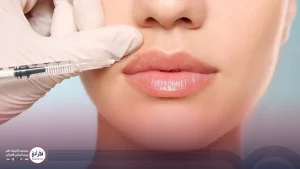 بهترین بی حسی برای تزریق ژل لب