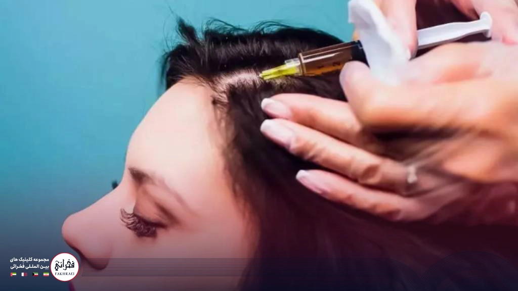 تزریق پی ار پی برای درمان ریزش مو