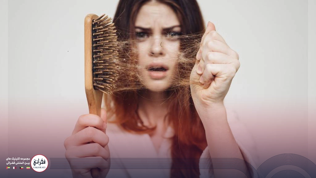 علتهای شایع ریزش مو در زنان و درمان آن