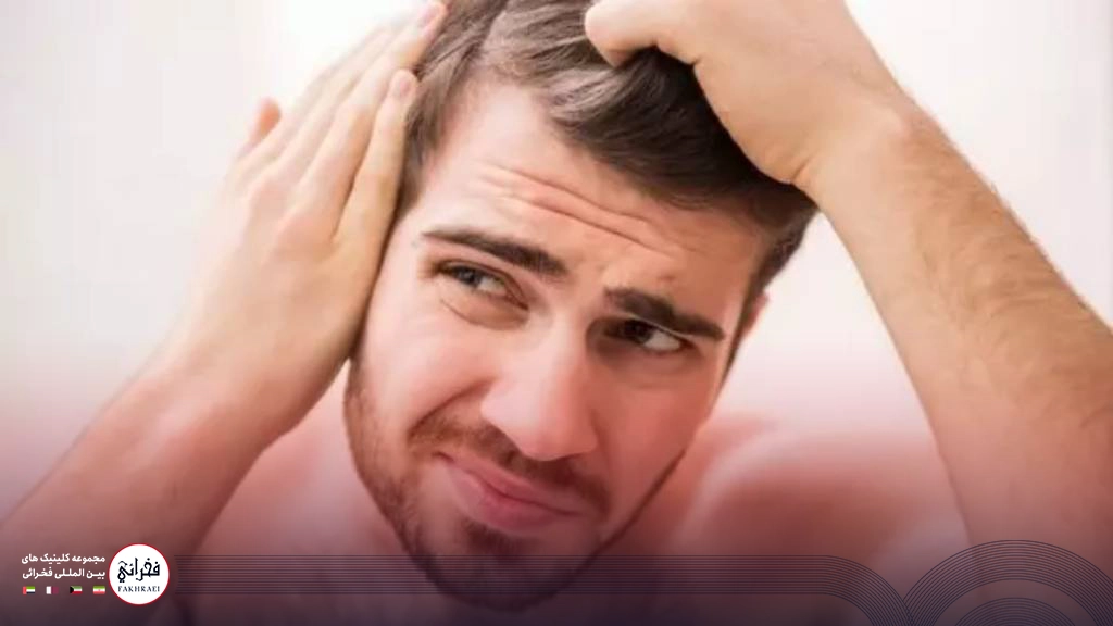 ریزش مو در مردان