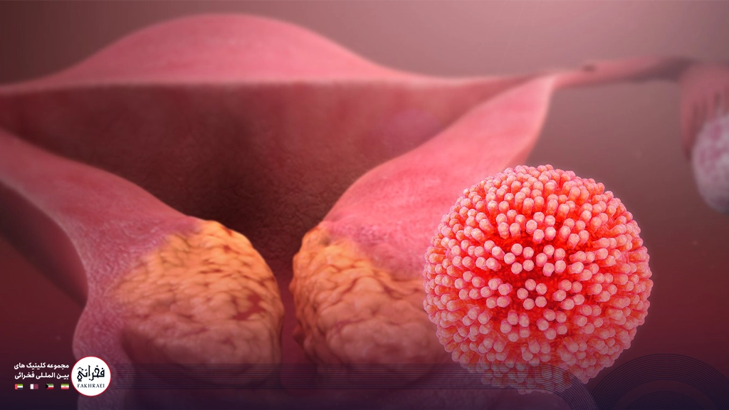 ویروس HPV که باعث زگیل تناسلی در رحم بانوان میشود