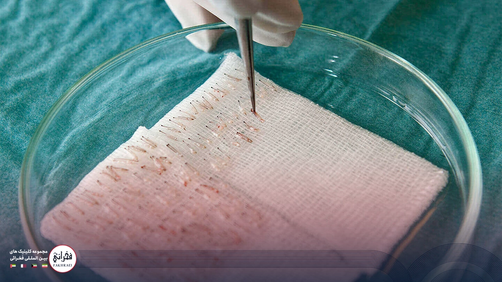 میکروگرافت